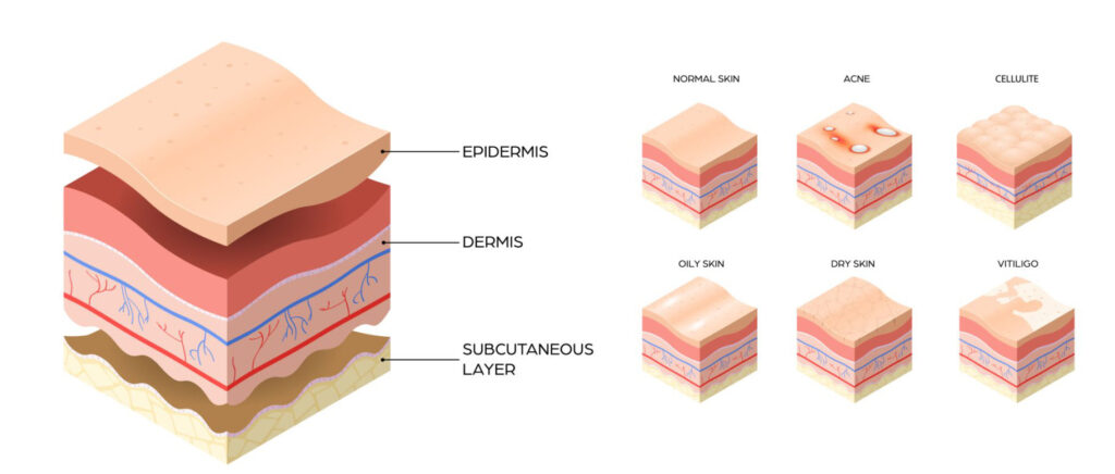 gli strati della pelle